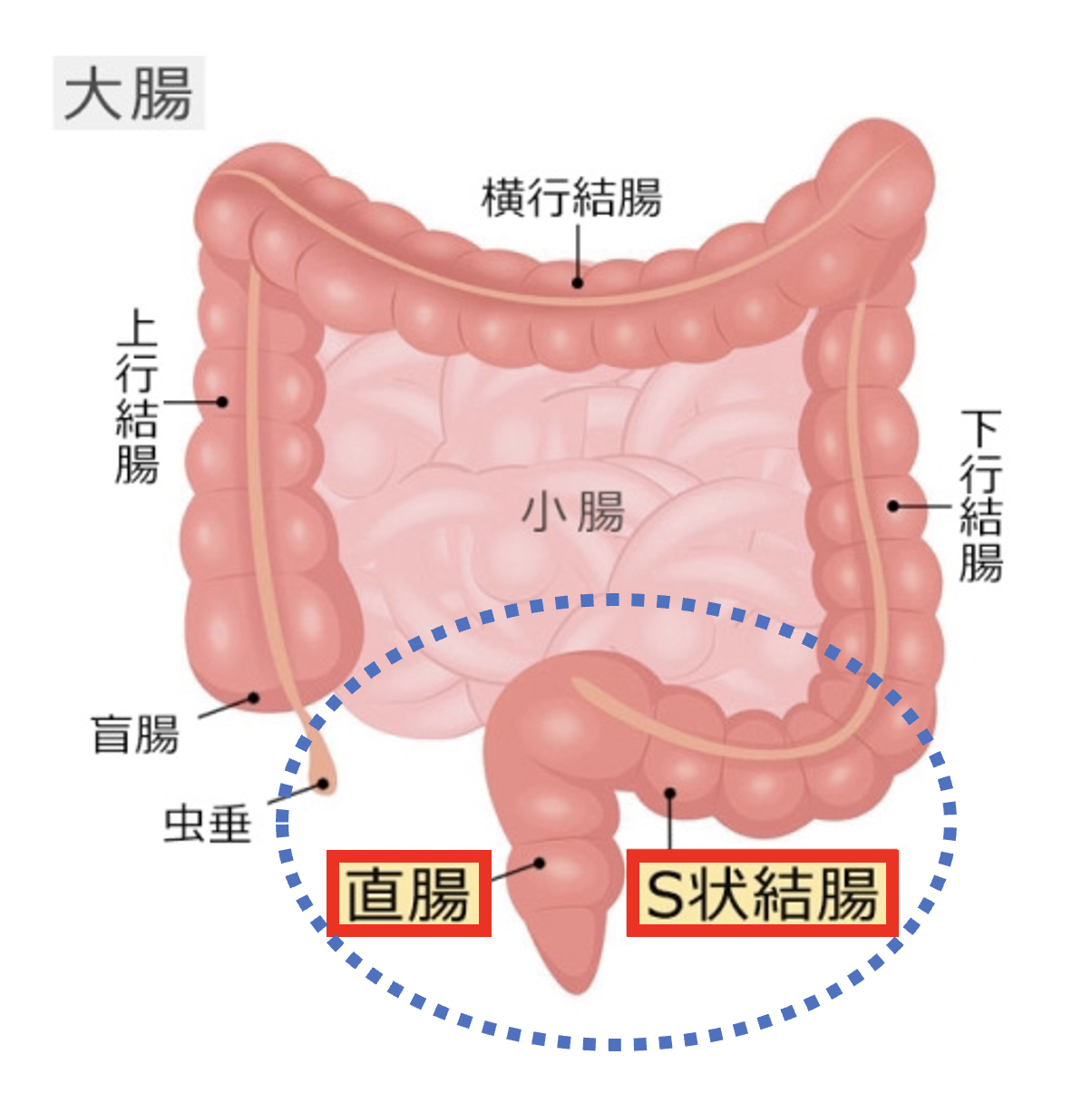 当院の簡易内視鏡検査(S状結腸内視鏡)の特徴